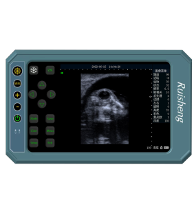 T6 full touch screen digital B ultrasound